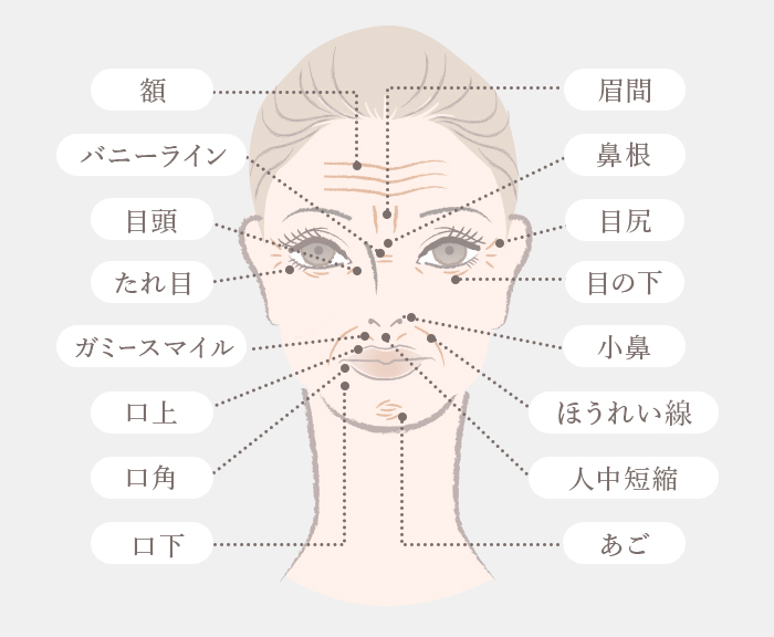 シワ取りボトックス部位