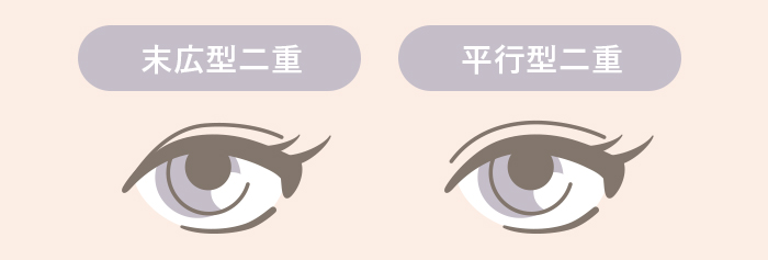 平行二重／末広二重