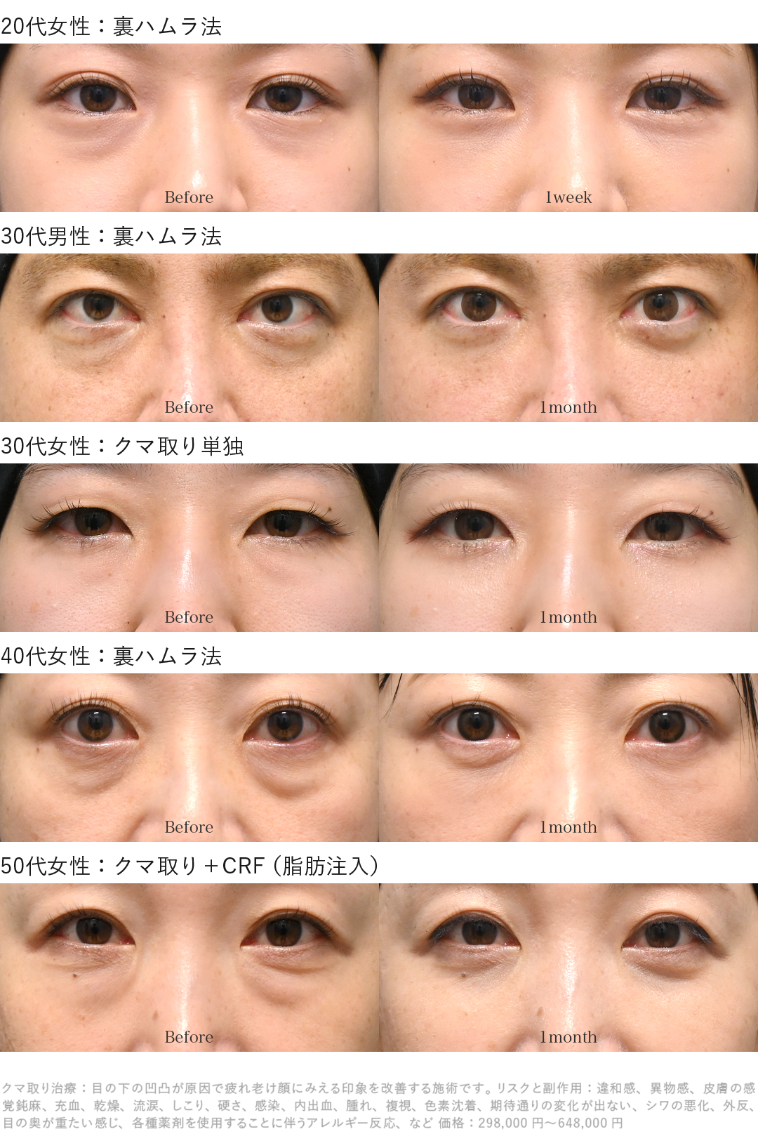 クマ取り年代別症例