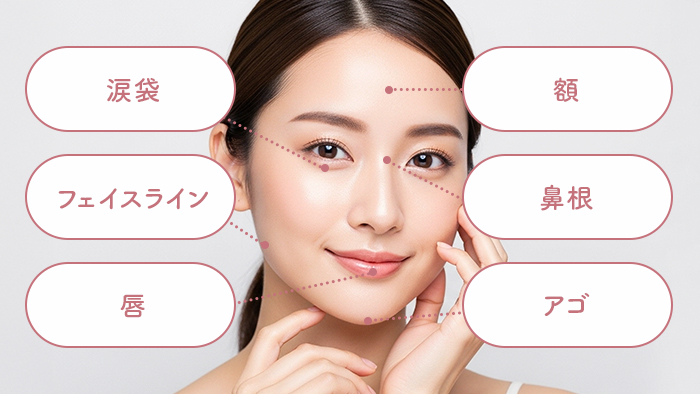 ヒアルロン酸注入部位_パーツの形を補正