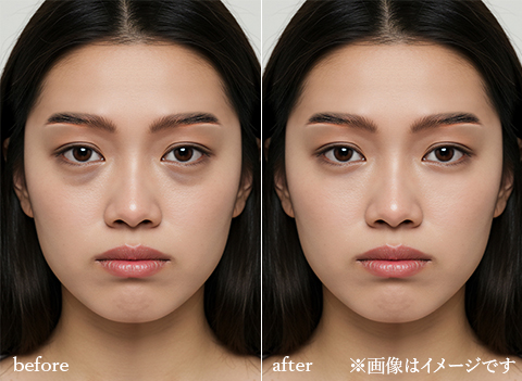 全顔モニタービフォーアフターイメージ画像