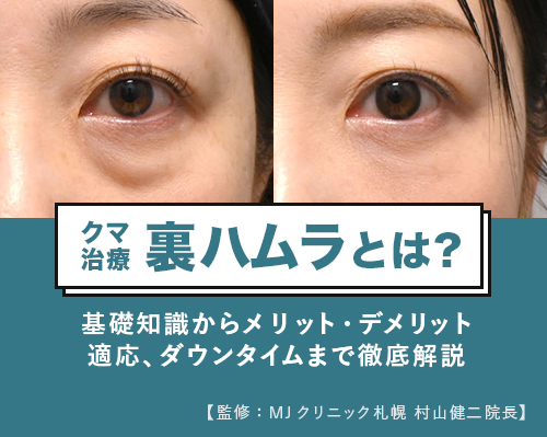 裏ハムラとは_MJクリニック村山健二院長監修