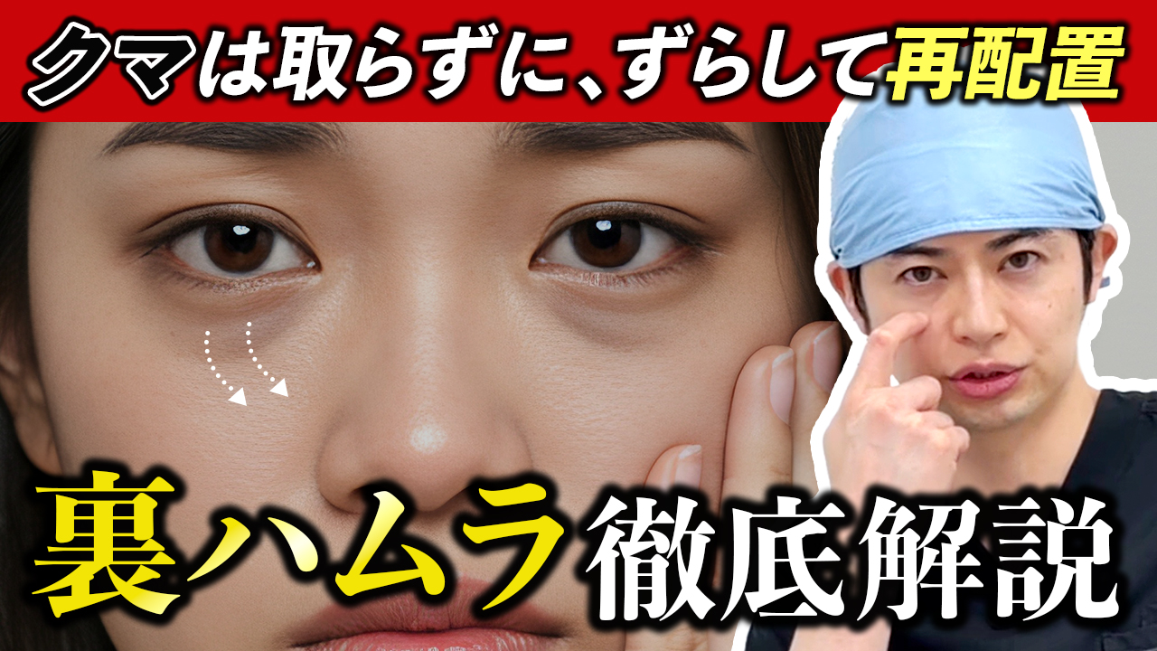 裏ハムラ徹底解説