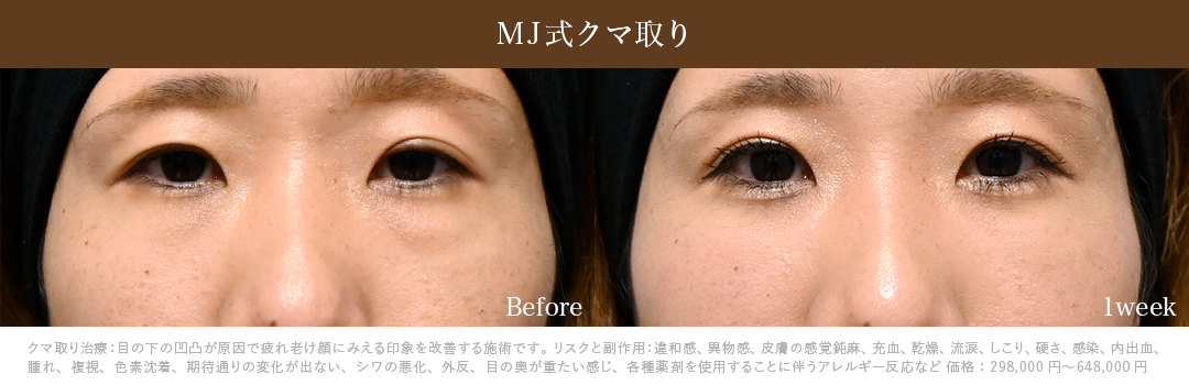 MJ式クマ取り単独症例_1週間後