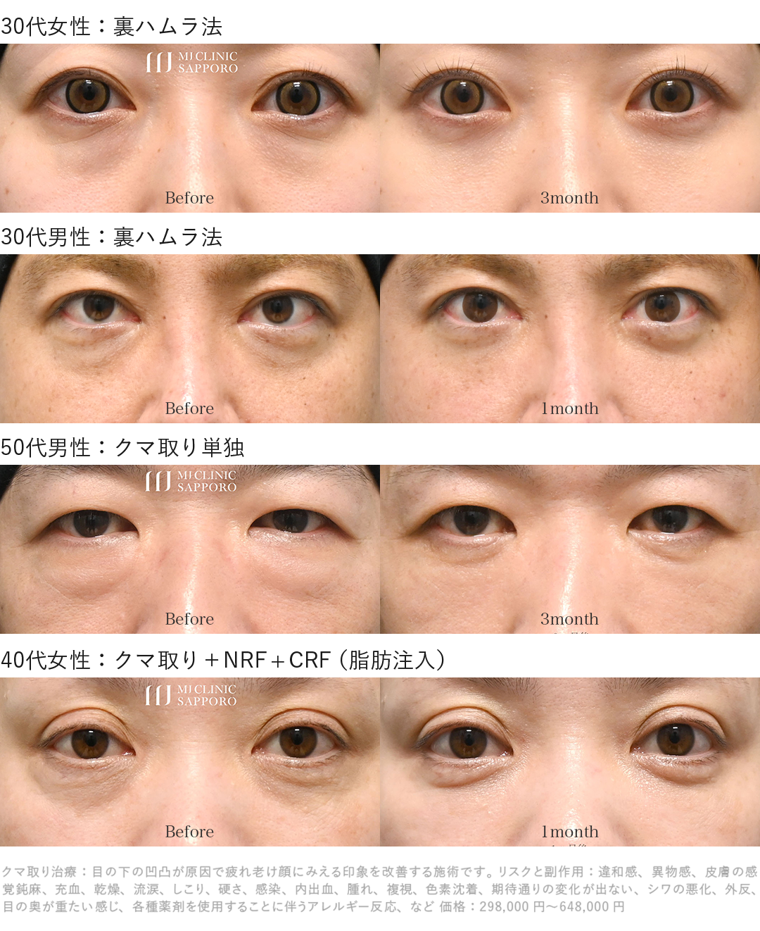 クマ取り_クマ治療症例