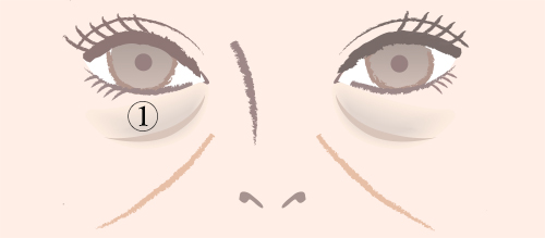 クマ取り_疲れ顔の原因_眼窩脂肪の膨らみ