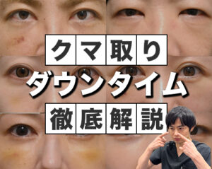 クマ取りダウンタイム完全攻略ガイド