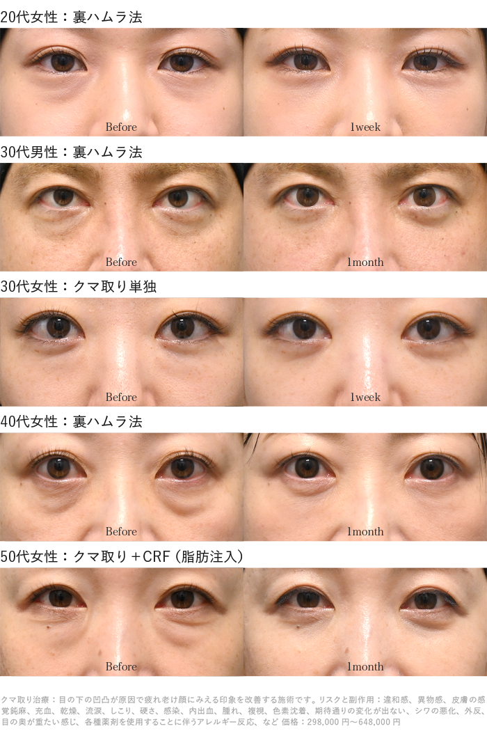 クマ取り年代別症例