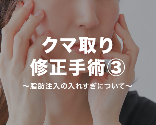 クマ取りの修正手術③脂肪注入の入れすぎについて