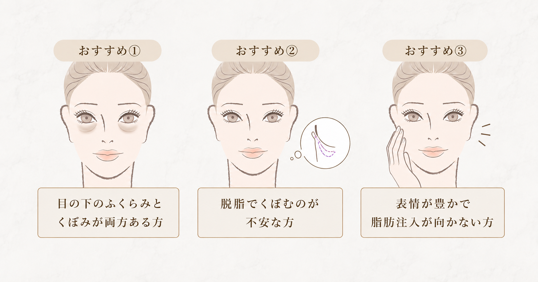 裏ハムラ法の適応｜こんな方におすすめ