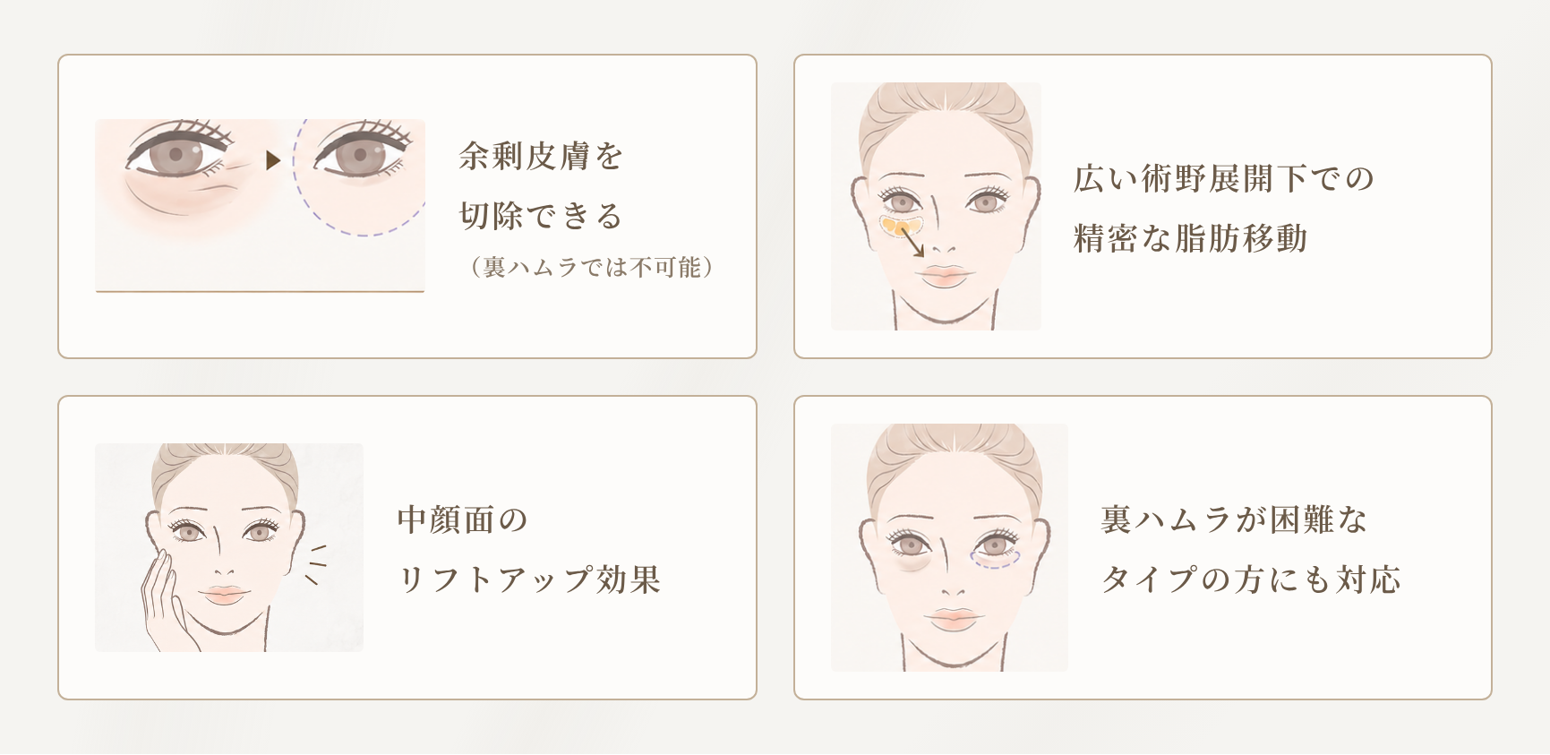 表ハムラのメリット4つ｜余剰皮膚を切除できる・広い術野での精密な脂肪移動・中顔面リフトアップ効果・裏ハムラが困難なタイプにも対応(札幌MJクリニック)