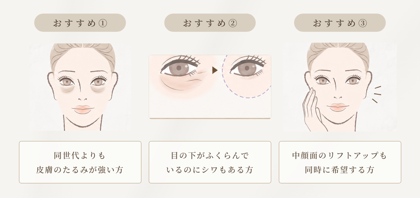 表ハムラがおすすめの方｜皮膚のたるみが強い方・ふくらみとシワが両方ある方・中顔面のリフトアップも希望する方(札幌MJクリニック)